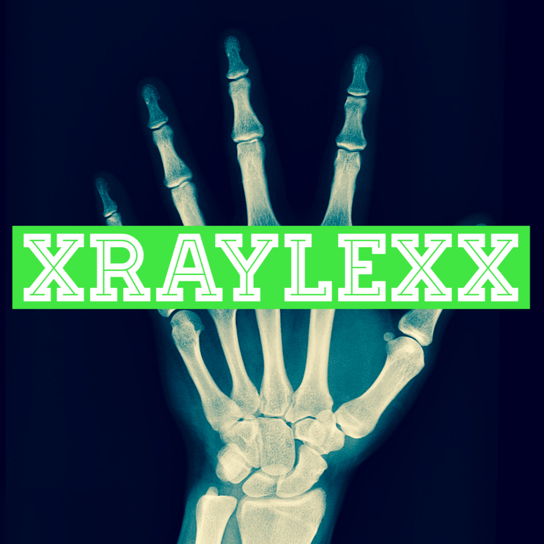XRayLexx